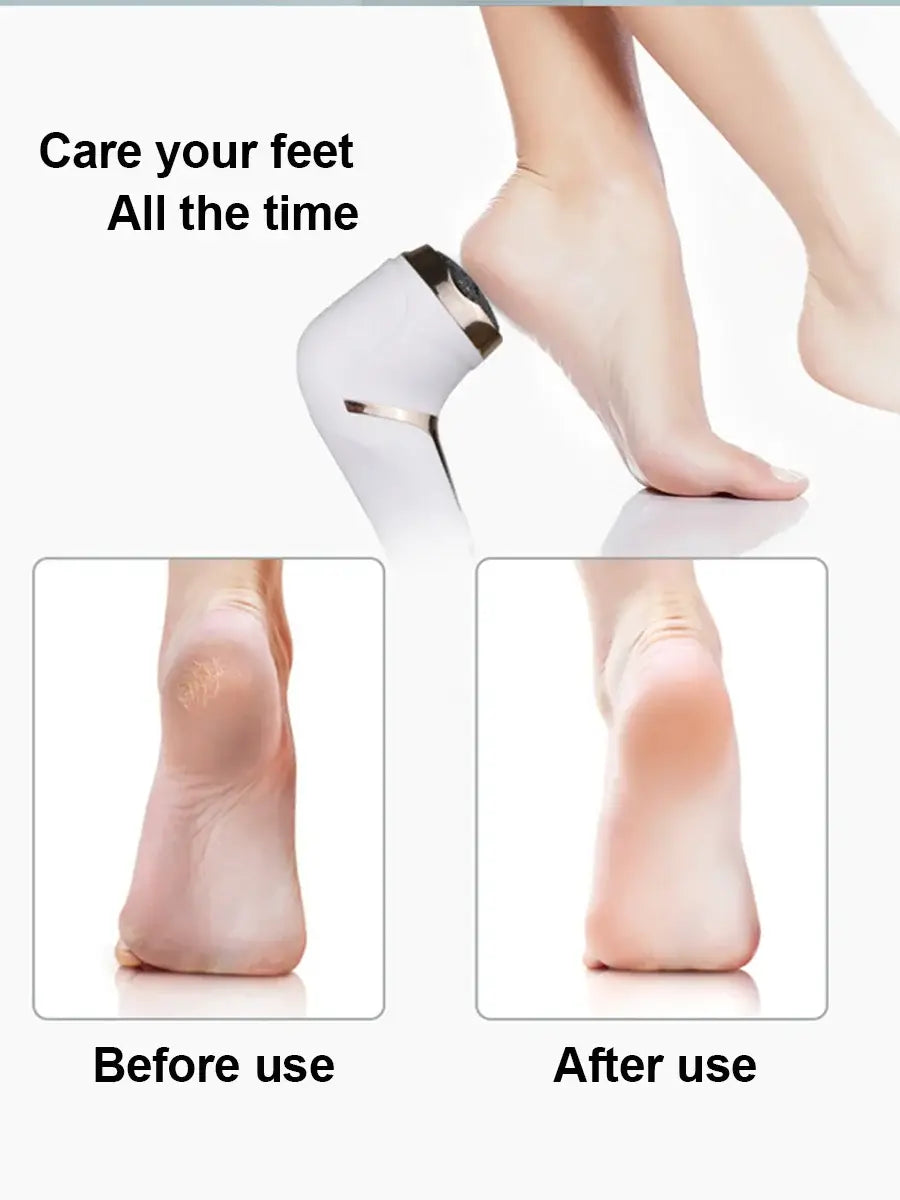 NEW Rechargeable Electric Foot File Callus Remover